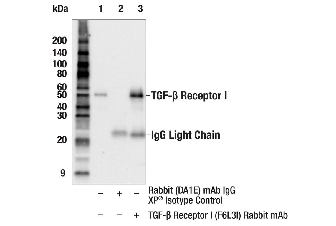 Immunoprecipitation Image 1: TGF-β Receptor I (F6L3I) Rabbit mAb