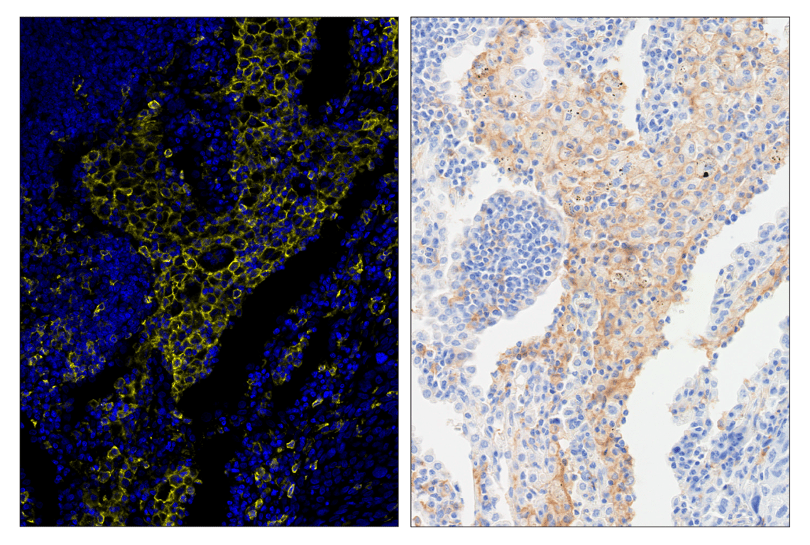 Immunohistochemistry Image 6: CD14 (D7A2T) & CO-0085-594 SignalStar<sup>™</sup> Oligo-Antibody Pair