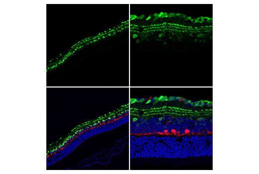 Immunofluorescence Image 1: Calretinin (E7R6O) XP<sup>®</sup> Rabbit mAb