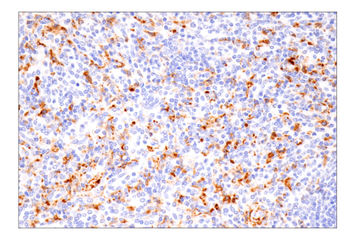 Immunohistochemistry Image 4: CD68 (D4B9C) XP<sup>®</sup> Rabbit mAb (BSA and Azide Free)