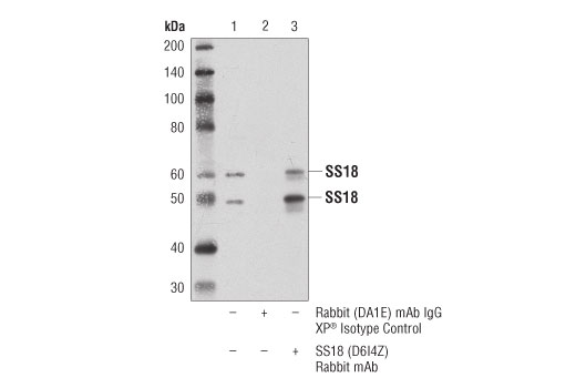 undefined Image 18: BAF Complex IHC Antibody Sampler Kit