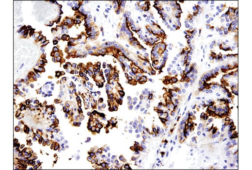 Immunohistochemistry Image 3: OLFM4 (D1E4M) XP<sup>®</sup> Rabbit mAb