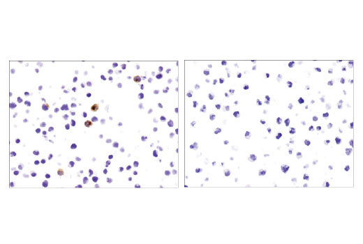 Immunohistochemistry Image 2: CD40 Ligand (D5J9Y) Rabbit mAb