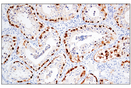 Immunohistochemistry Image 6: MAGE-A4 (E7O1U) XP<sup>®</sup> Rabbit mAb