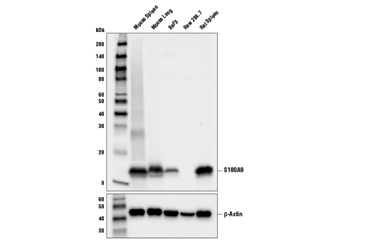 Western Blotting Image 1: S100A9 (D3U8M) Rabbit mAb