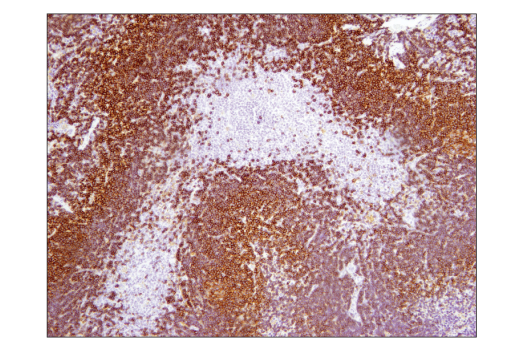 Immunohistochemistry Image 3: CD19 (Intracellular Domain) (D4V4B) XP<sup>®</sup> Rabbit mAb (BSA and Azide Free)