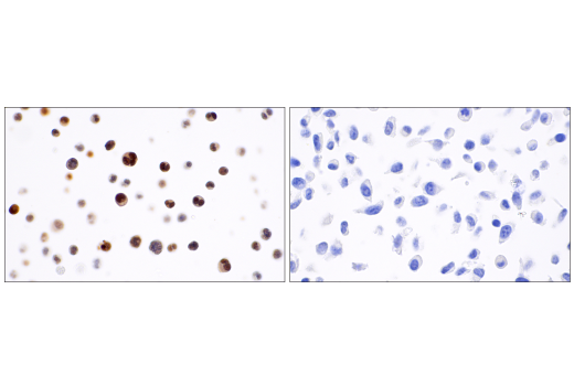 Immunohistochemistry Image 7: RUNX3/AML2 (D6E2) Rabbit mAb