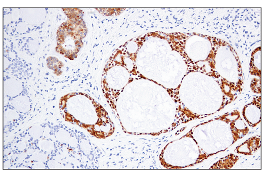 Immunohistochemistry Image 1: MAGE-A4 (E7O1U) XP<sup>®</sup> Rabbit mAb