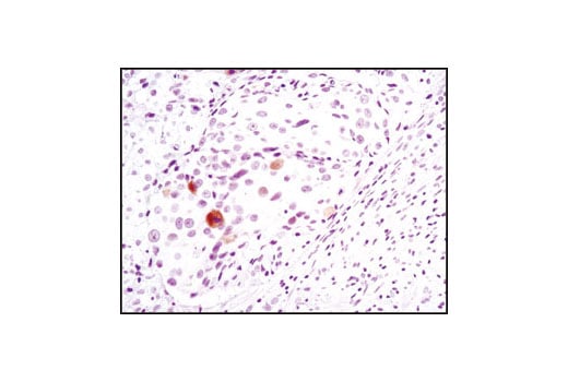 undefined Image 3: PhosphoPlus<sup>®</sup> Chk2 (Thr68) Antibody Duet