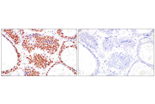 Immunohistochemistry Image 13: TIF1α/TRIM24 (E9T3N) Rabbit mAb