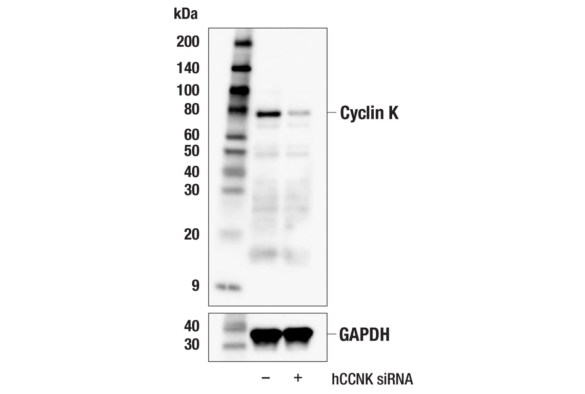 Western Blotting Image 1: Cyclin K (E7F4N) Rabbit mAb