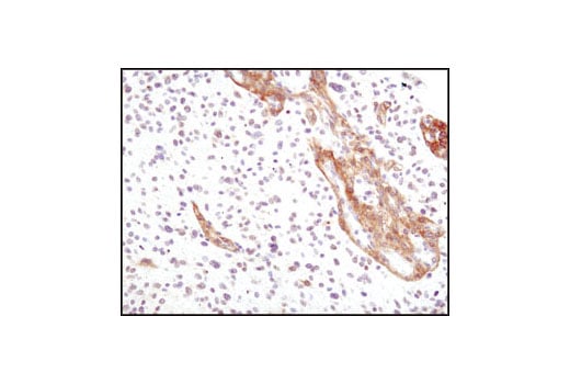 Immunohistochemistry Image 1: PDGF Receptor α (D1E1E) XP<sup>®</sup> Rabbit mAb