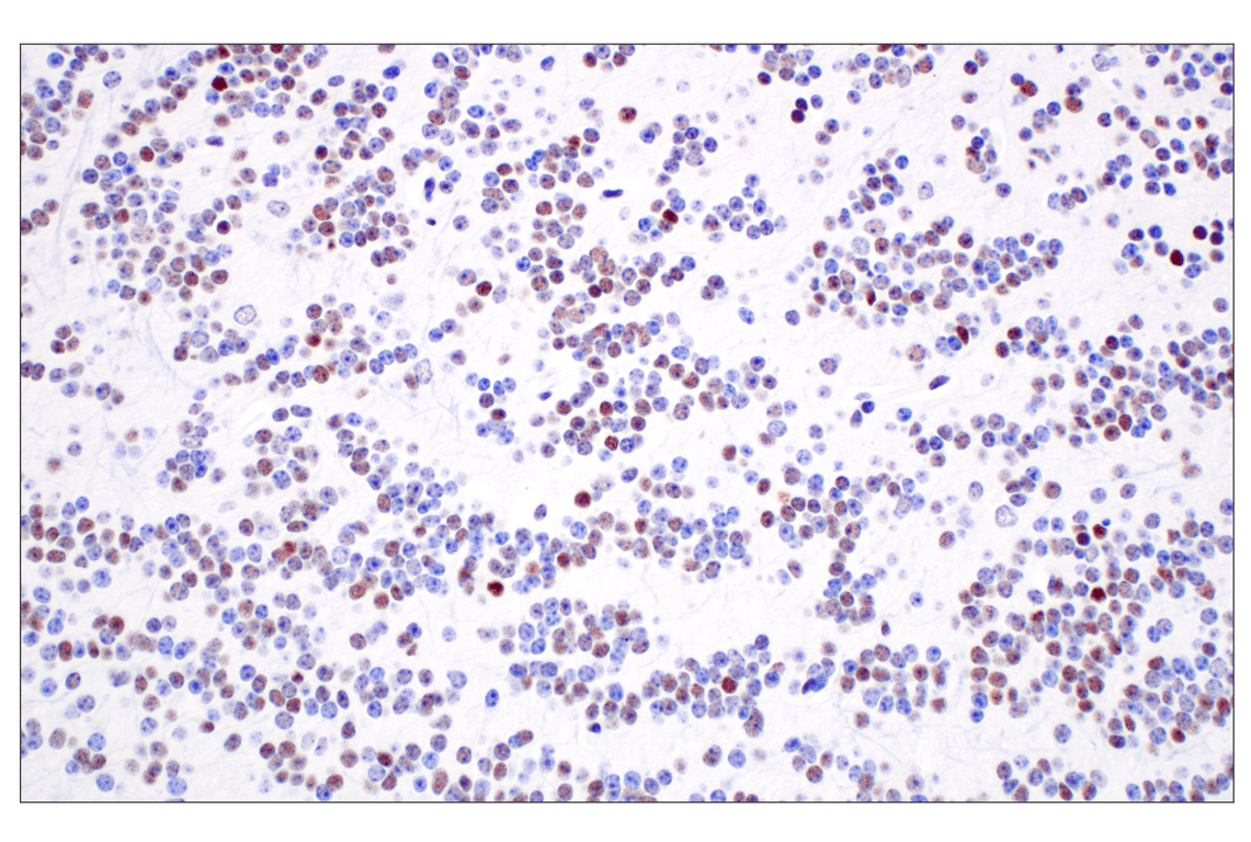 Immunohistochemistry Image 6: TCF4/ITF2 (E3X2Y) Rabbit mAb