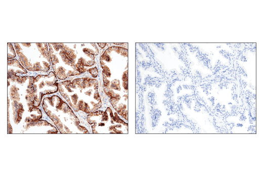 Immunohistochemistry Image 5: CD47 (D3O7P) Rabbit mAb