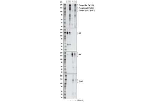 Western Blotting Image 1: Phospho-Axl (Tyr698)/Mer (Tyr749)/Tyro3 (Tyr681) (D6M4W) Rabbit mAb