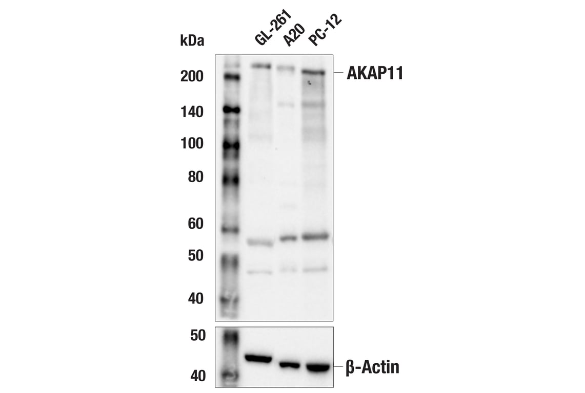 Western Blotting Image 2: AKAP11 (E9E6W) Rabbit mAb