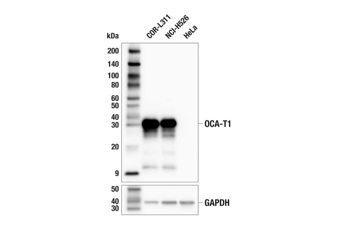 Western Blotting Image 1: OCA-T1 (E4T1K) Rabbit mAb (BSA and Azide Free)