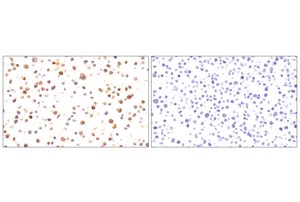 Immunohistochemistry Image 8: SLC40A1/Ferroportin-1 (F9U5S) Rabbit mAb