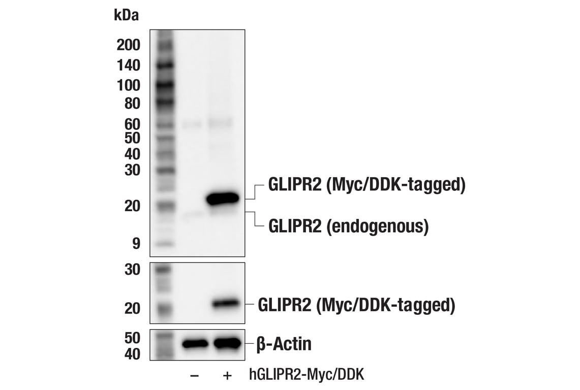 Western Blotting Image 3: GLIPR2 (F7H7V) Rabbit mAb