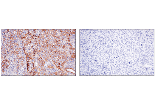 Immunohistochemistry Image 4: CD151 (E4I9J) XP<sup>®</sup> Rabbit mAb