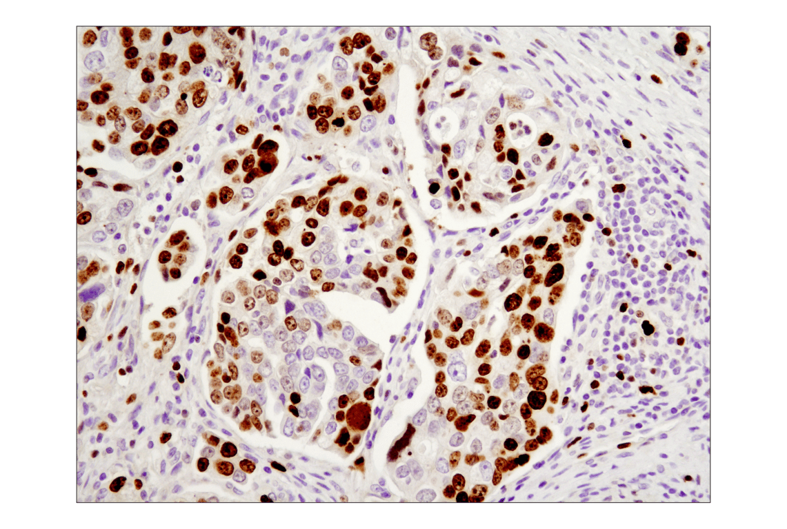 Immunohistochemistry Image 3: Ki-67 (8D5) Mouse mAb