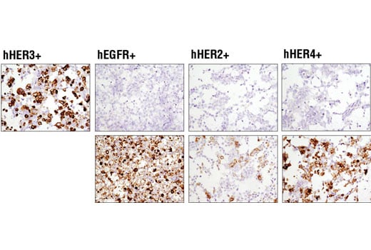 Immunohistochemistry Image 4: HER3/ErbB3 (D22C5) XP<sup>®</sup> Rabbit mAb