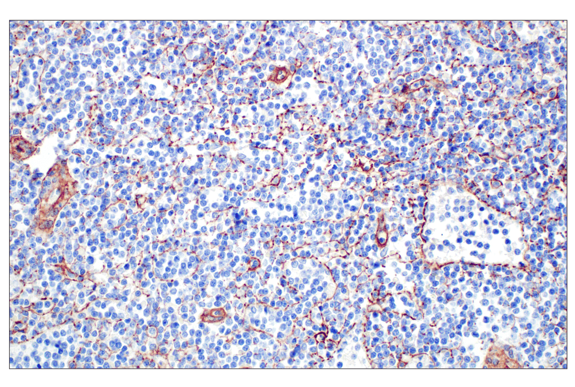 Immunohistochemistry Image 3: COL4A1 (E5M6R) Rabbit mAb (BSA and Azide Free)