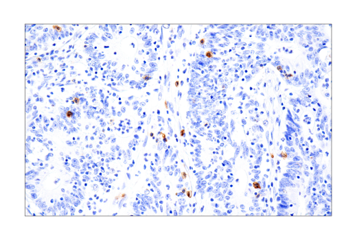 Immunohistochemistry Image 2: B3GAT1 (NK-1) Mouse mAb