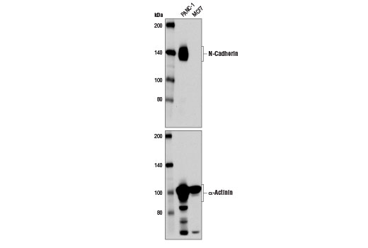 Western Blotting Image 1: N-Cadherin (13A9) Mouse mAb