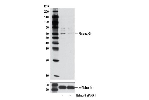 Western Blotting Image 1: Rabex-5 (D21F12) Rabbit mAb