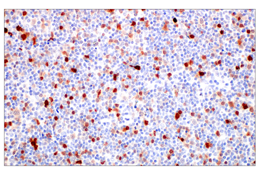 Immunohistochemistry Image 5: p16 INK4A (BC42) Mouse mAb