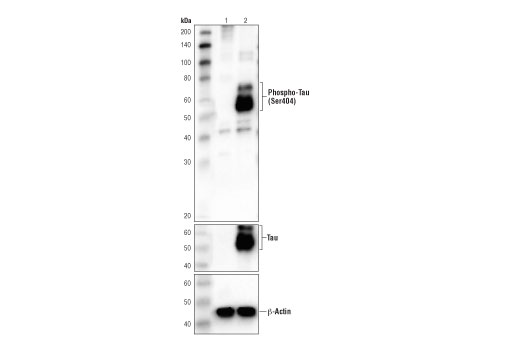 undefined Image 27: LRP1-mediated Endocytosis and Transmission of Tau Antibody Sampler Kit