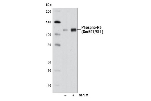 Western Blotting Image 2: Phospho-Rb (Ser807/811) (D20B12) XP<sup>®</sup> Rabbit mAb (BSA and Azide Free)