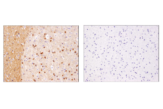 Immunohistochemistry Image 1: Phospho-Tau (Ser416) (D7U2P) Rabbit mAb (BSA and Azide Free)