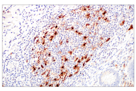 Immunohistochemistry Image 7: LAMP3/CD208 (E6E5U) XP<sup>®</sup> Rabbit mAb (BSA and Azide Free)