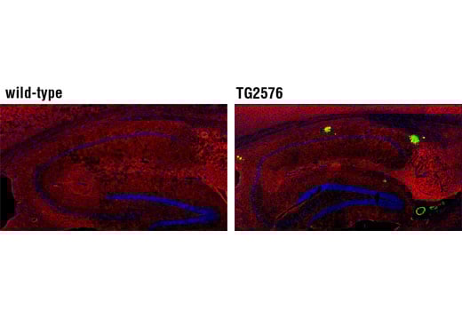undefined Image 17: β-Amyloid Antibody Sampler Kit