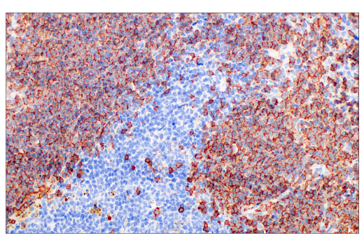 Immunohistochemistry Image 1: CD20 (E3N7O) XP<sup>®</sup> Rabbit mAb (BSA and Azide Free)