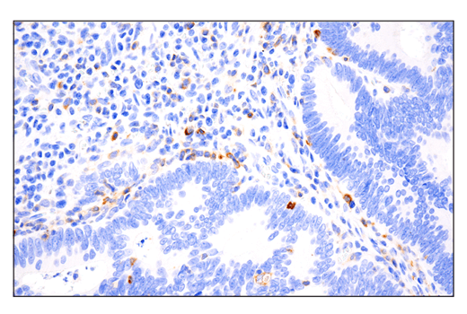 Immunohistochemistry Image 3: Phospho-SLP-76 (Ser376) (E3G9U) XP<sup>®</sup> Rabbit mAb