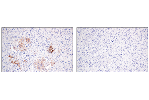 Immunohistochemistry Image 1: Enolase-2 (E2H9X) XP<sup>®</sup> Rabbit mAb