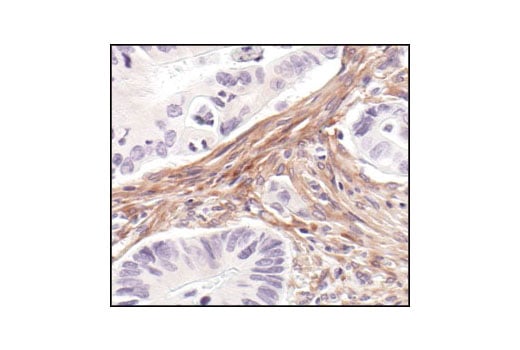 Immunohistochemistry Image 1: PDGF Receptor β (28E1) Rabbit mAb