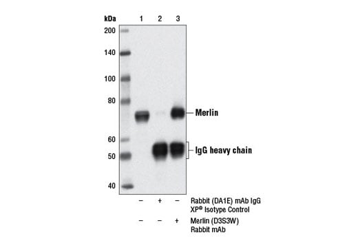 Immunoprecipitation Image 1: Merlin (D3S3W) Rabbit mAb