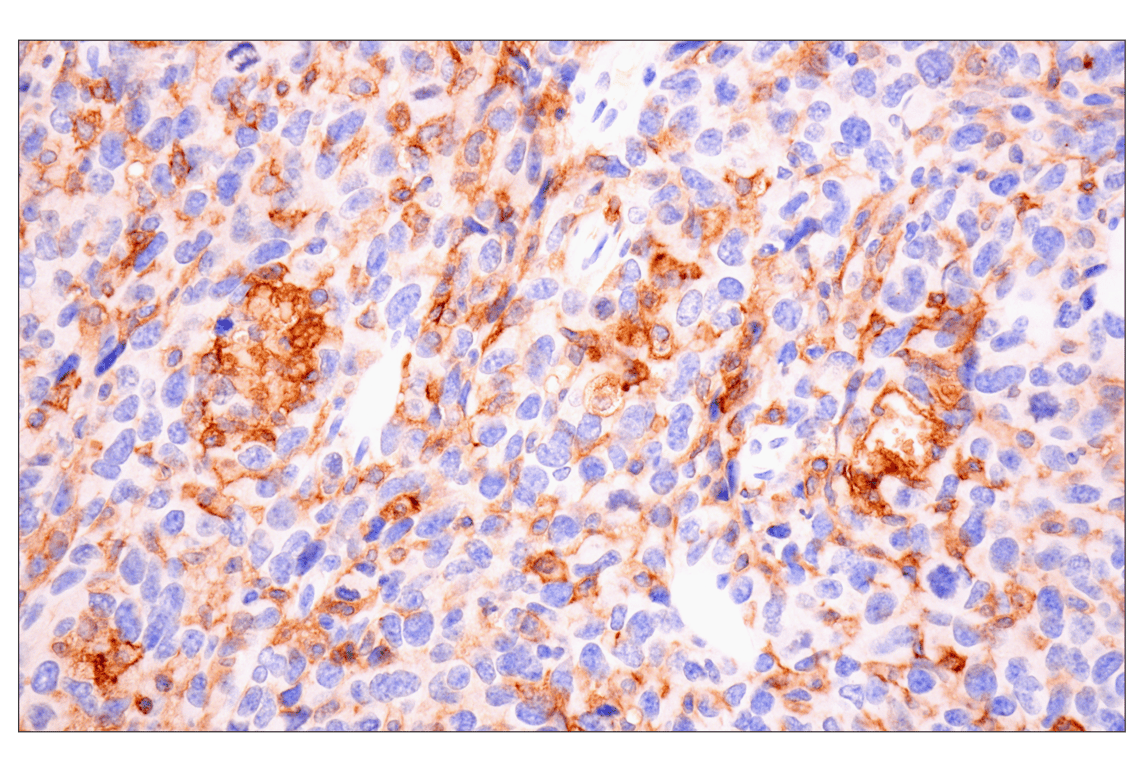 Immunohistochemistry Image 3: CD14 (D1U2Y) Rabbit mAb