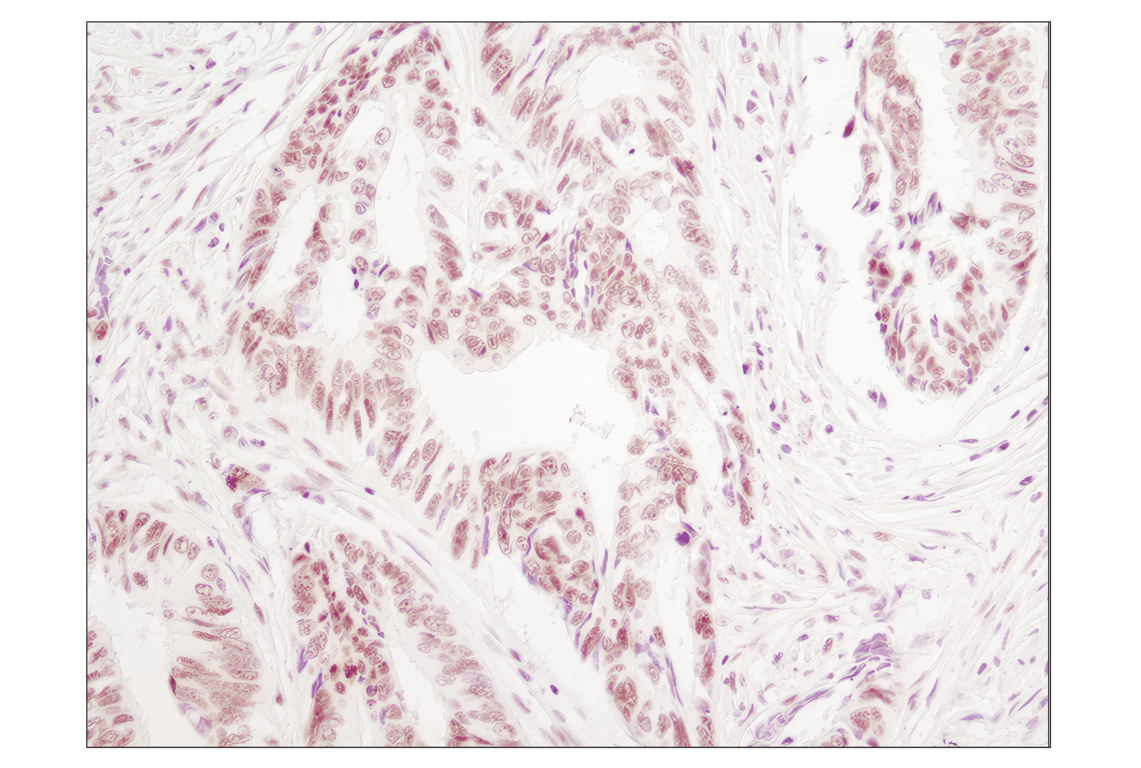 undefined Image 21: Angiogenesis Antibody Sampler Kit