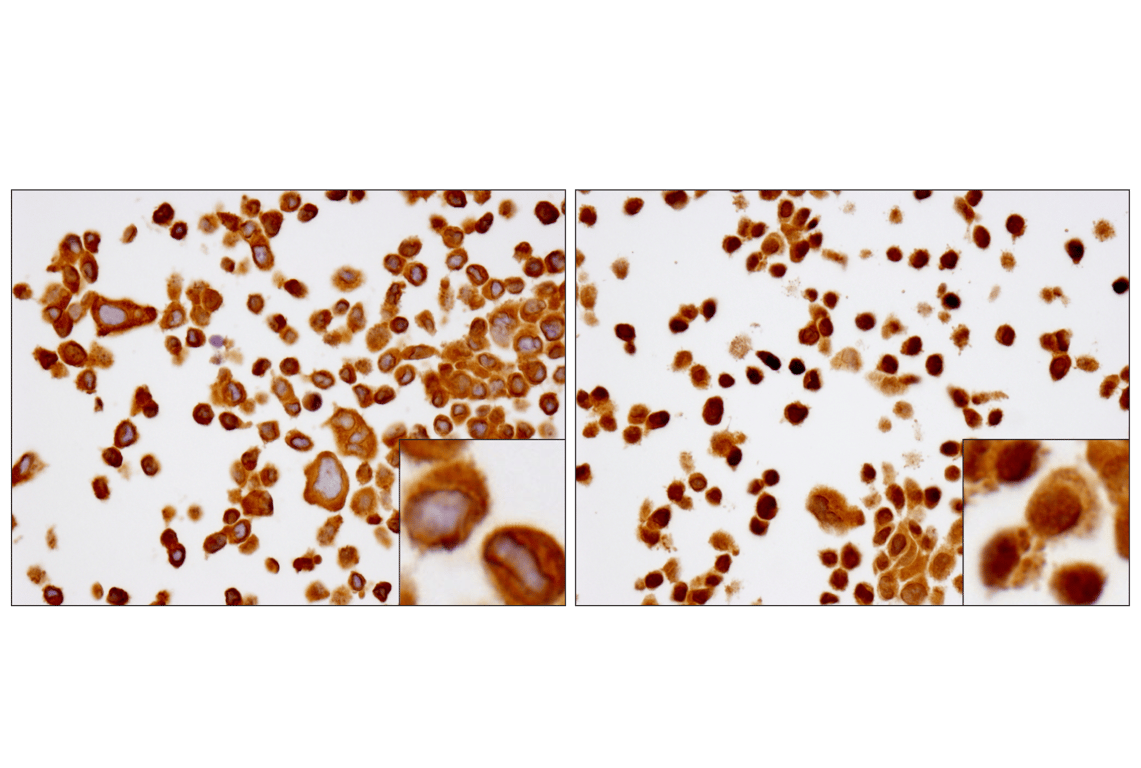 undefined Image 7: PhosphoPlus<sup>®</sup> NF-κB p65/RelA (Ser536) Antibody Duet