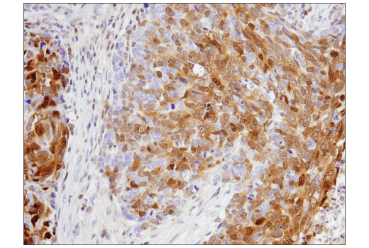 Immunohistochemistry Image 3: p27 Kip1 (SX53G8.5) Mouse mAb (IHC Formulated)