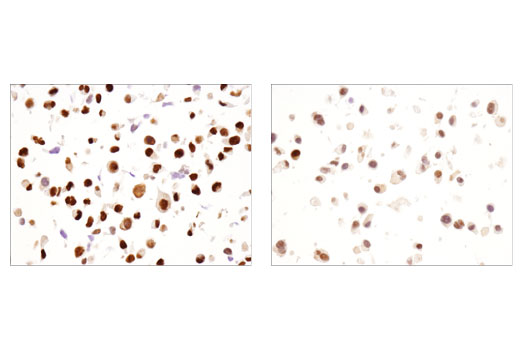 Immunohistochemistry Image 4: Sox9 (D8G8H) Rabbit mAb