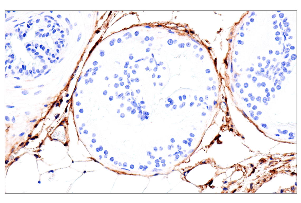 Immunohistochemistry Image 3: DPEP-1/MDP (E5H7T) Rabbit mAb
