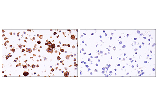 Immunohistochemistry Image 1: 4-1BB/CD137/TNFRSF9 (E6Z7F) XP<sup>®</sup> Rabbit mAb