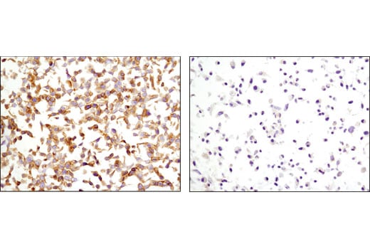 HER3/ErbB3 (D22C5) XP® Rabbit mAb (#12708) Datasheet With