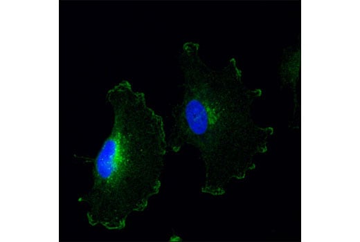 Immunofluorescence Image 1: Notch2 (D76A6) XP<sup>®</sup> Rabbit mAb (BSA and Azide Free)